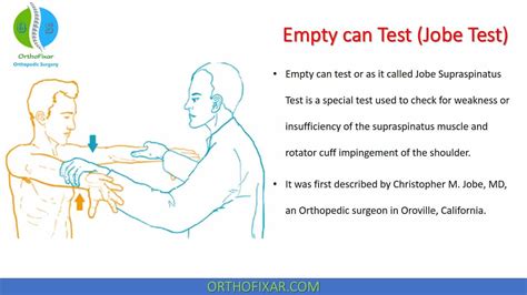 Jobe’s empty can test was first described in 1983. This sets out to preferentially test supraspinatus (complete isolation of supraspinatus from the deltoid is …